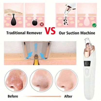 UBA™ – Electric Acne Pore Cleaner &amp; Blackhead Remover